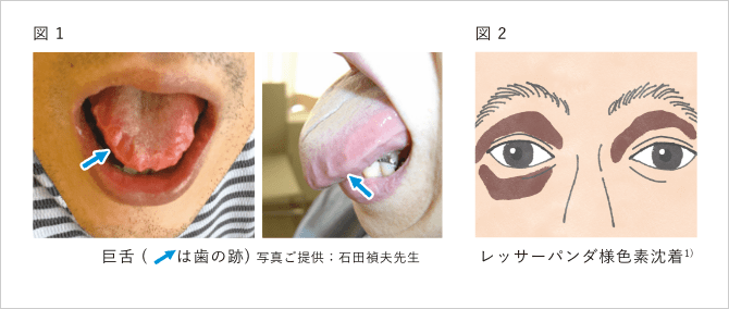 「最初にみられる症状は？」の説明画像