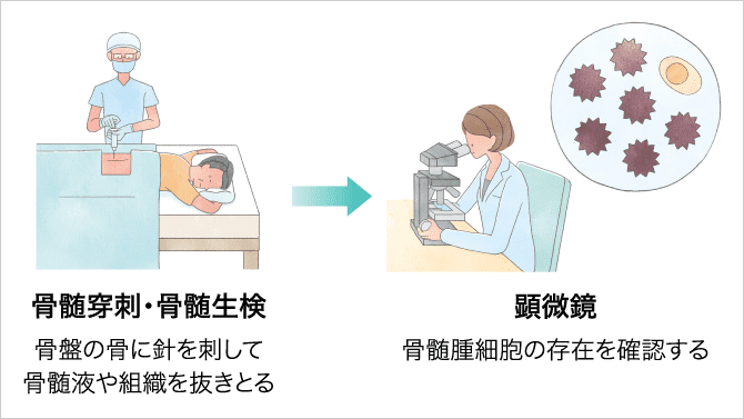 「骨髄検査」の説明画像