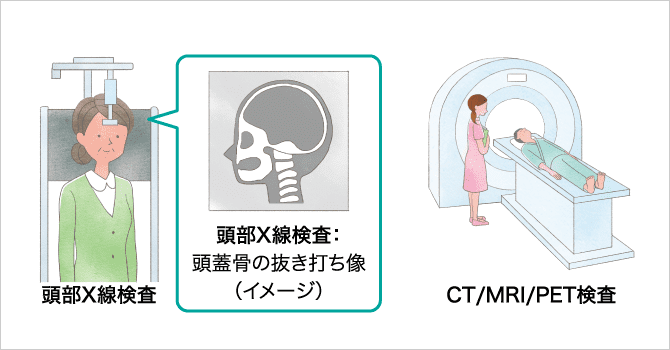 「画像検査（レントゲン、CT、MRIなど）」の説明画像