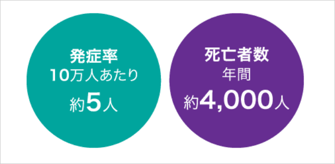 「頻度」の説明画像