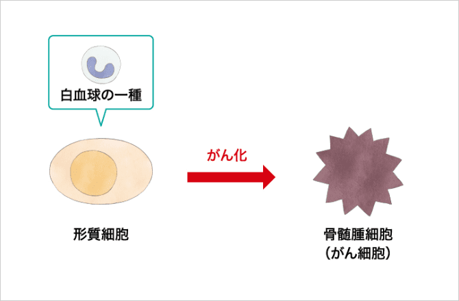 「白血球の一つである形質細胞ががん細胞に変わる」の説明画像